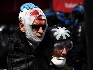 An injured protester is assisted by a street medic prior to the start of the annual May Day rally in Paris. A heady mix of labour unionists, 'yellow vest' demonstrators and hardline hooligans are expected to hit the streets today for Labour Day  (AFP)