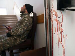  عملية السلام يمكن أن تبدأ فقط في حالة انضمام تركيا لمحادثات الوساطة