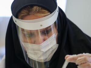 "بروز الأمراض الحيوانية المنشأ مرتبط في غالب الاحيان بالتغيرات البيئية 
