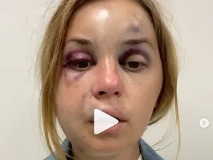 مذيعة تلفزيون أوكرانية تتعرض للضرب ومحاولة اغتصاب أمام ابنها