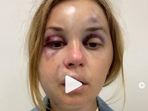 مذيعة تلفزيون أوكرانية تتعرض للضرب ومحاولة اغتصاب أمام ابنها