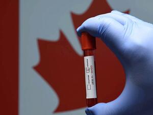 أكثر من 10 آلاف وفاة بكورونا في كندا