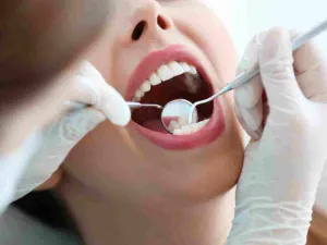 من فوائد تنظيف الأسنان يحسن صحة الفم ويمنحه الانتعاش