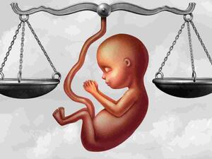 إجهاض الجنين المُعاق