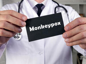 Spain Confirms 31 Monkeypox Cases
