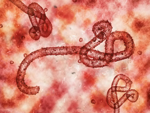 Marburg Deadly Virus: Everything You Need to Know