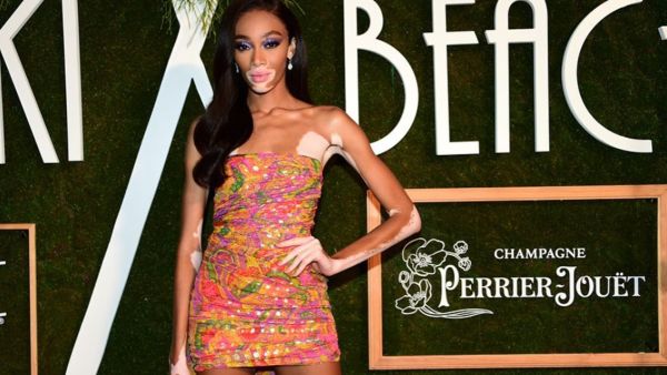 Winnie Harlow