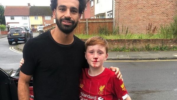 Ouch! Mohamed Salah with Louis - and his cut nose - after the 11-year-old crashed into a lamppost chasing him. (Liverpool Echo)