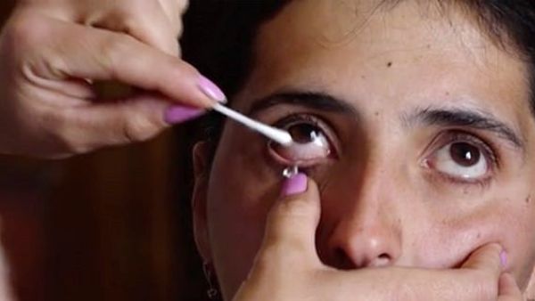 Satenik's relative can be seen drawing one of the crystal tears from her eye using a cotton bud. Svetlana Avagyan said that she thought it was glass when they took the first one out (https://www.dailymail.co.uk/Sputnik)