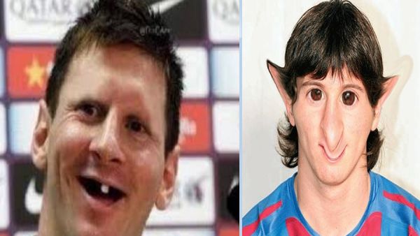 ميسي- تشويه