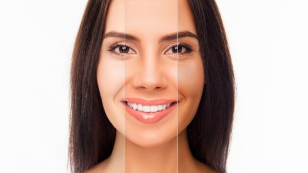  يعتبر مزج عصير الليمون مع الموز من أفضل الوصفات لأجل الحصول على بشرة لامعة ومشرقة