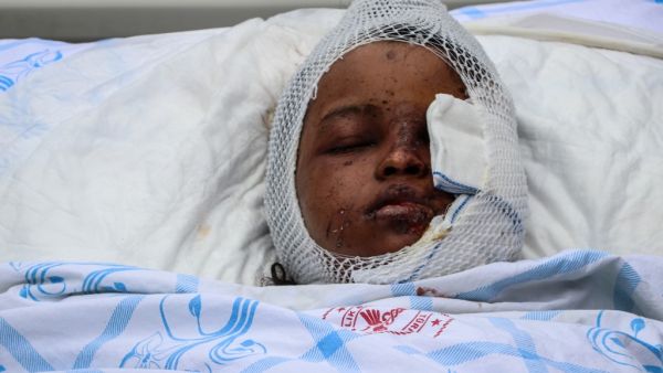 A wounded girl, from the December 28, 2019 car bombing in Mogadishu, is carried on a hospital bed to a Turkish Air Force aircraft for medical evacuation to Turkey at the Adan Adde international airport in Mogadishu on December 29, 2019. (AFP/ File Photo)