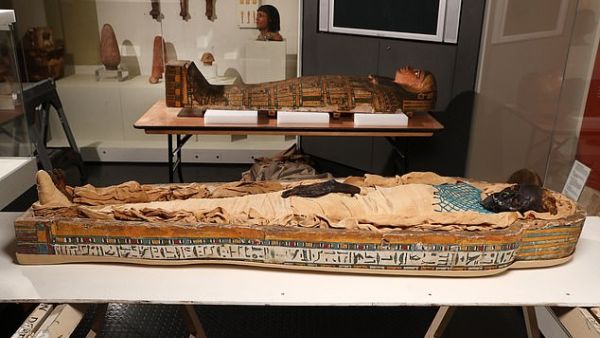 Takabuti was also found to have two bizarre traits seen only in a minority of the population. She had an extra tooth - 33 instead of the normal 32. (University of Manchester)