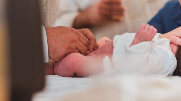 Circumcision ceremony (Shutterstock)	