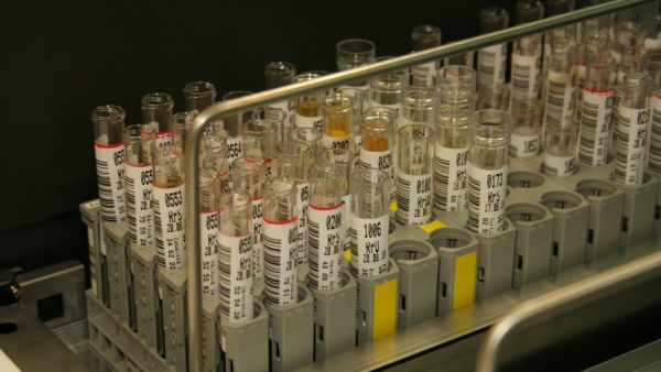 ما دلالة تغير لون البول أثناء الحمل؟