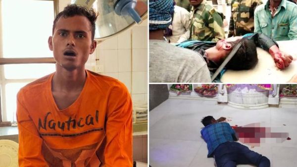 Chopped off His Own Tongue to End the Coronavirus; Indian Man Hospitalized Post Complications