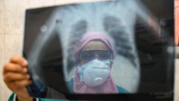 In this file photo taken on April 19, 2020, an Egyptian doctor wearing two protective masks checks a patient's lung X-ray at the infectious diseases unit of the Imbaba hospital in the capital Cairo, during the COVID-19 coronavirus pandemic crisis. Months after Egypt reported its first coronavirus case, experts say the health system is approaching a "critical threshold" in its capacity to tackle the disease. The Arab world's most populous country of 100 million inhabitants has so far declared JUST OVER 12,00