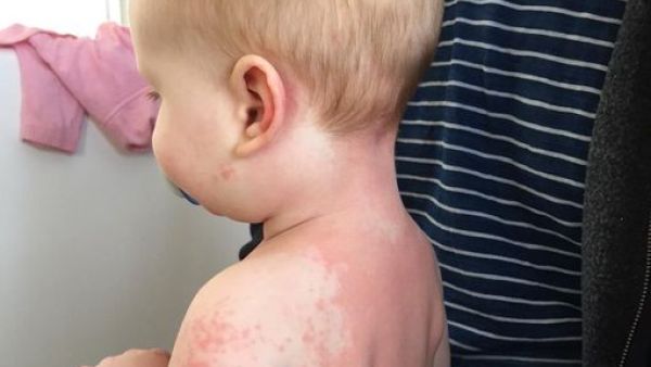 Eight month old Alexander Parsons (Twitter)