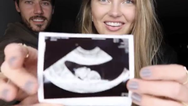 The Dutch model is expecting her first child with her husband (Twitter)