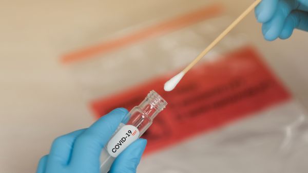That virus, named RaBtCoV/4991 at the time, now appears to be the closest relative to SARS-Cov-2, which is causing Covid-19. (Shutterstock/ File Photo)