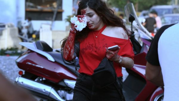 A wounded woman covers her eye following of an explosion at the port of the Lebanese capital Beirut, on August 4, 2020. Rescuers searched for survivors in Beirut after a cataclysmic explosion at the port sowed devastation across entire neighbourhoods, killing more than 100 people, wounding thousands and plunging Lebanon deeper into crisis. AFP