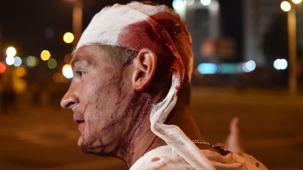An injured man is seen during clashes between riot police and opposition supporters in Minsk on August 10, 2020. A man died during rallies in Belarus on August 10 night when an explosive device went off in his hand, police said, confirming the first casualty of post-election protests. Sergei GAPON / AFP