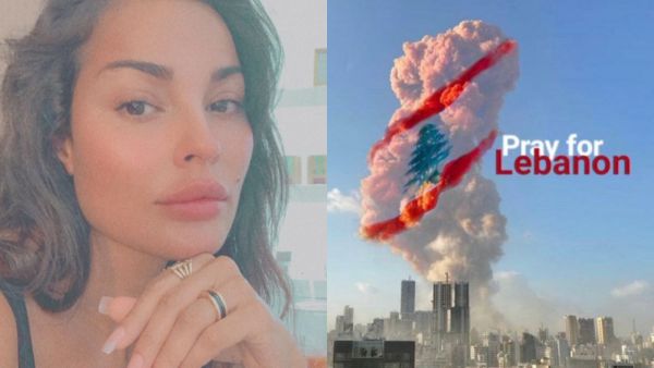 After Reported Missing ... Nadine Njeim Suffers a Serious Injury in Beirut Explosion & Undergoes a 6 Hour Urgent Surgery (Picture)