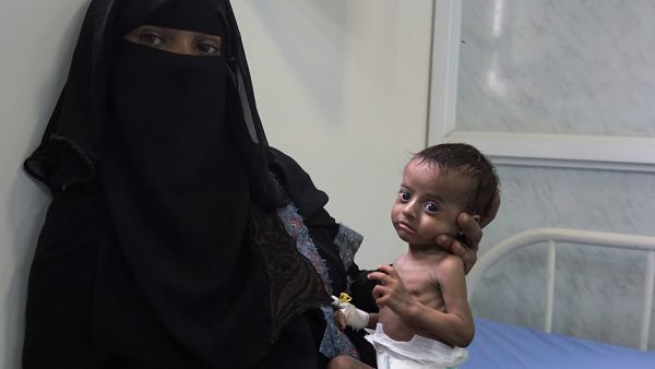 “أوضاع مأساوية” تضرب اليمن