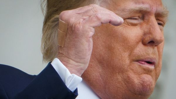 Bandages are seen on the back of his hand as US President Donald Trump speaks from the South Portico of the White House in Washington, DC during a rally on October 10, 2020. Trump spoke publicly for the first time since testing positive for Covid-19, as he prepares a rapid return to the campaign trail just three weeks before the election. MANDEL NGAN / AFP