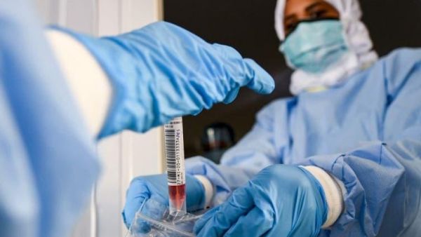 الوضع الوبائي في الأردن خطير جدا