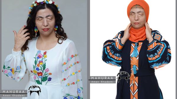 The 37-year-old Iranian acid attack survivor, Masoumeh Ataei. (Instagram)