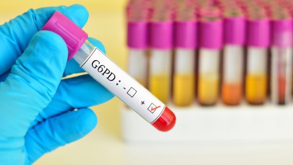 يظهر مرض التفول في أي عمر، وتتفاوت خطورة ذلك المرض بحسب نسبة نقص الإنزيم في الدم