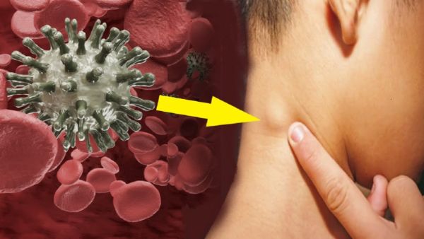  التاريخ العائلي لسرطانات الدم والنخاع العظمي