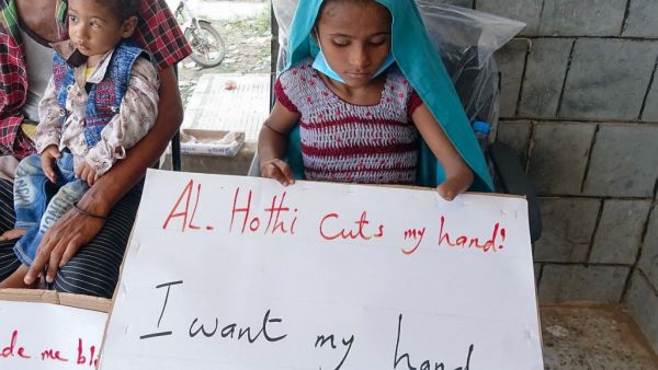 Yemeni war casualties lift anti-Huthi placards during the visit of the Deputy Head of the United Nations Mission to Support the Hodeida Agreement (UNMHA) Daniela Crosslake (unseen) to a hospital in Hays, in Yemen's western Hodeida province, on November 11, 2020. Khaled ZIAD / AFP