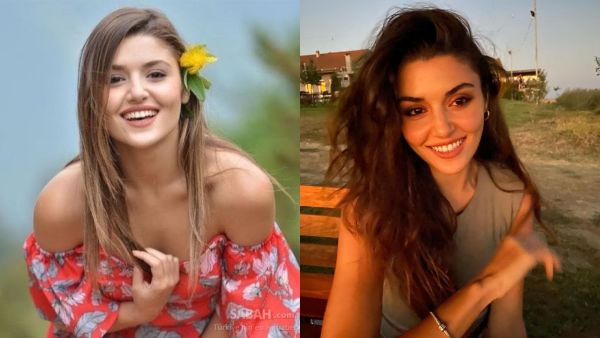 Before and Now Pictures: Hande Erçel Had Her Cheeks, Lips, Mouth and Eyes Done Despite of Denying It