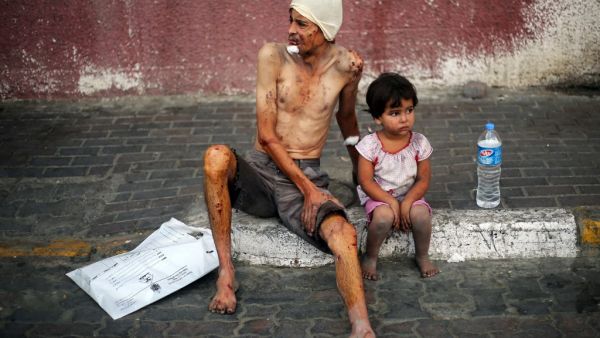 In this file photo taken on July 29, 2014 two Palestinians injured in Israeli air strikes wait outside the Khan Yunis hospital in the southern Gaza Strip. The International Criminal Court's ruling that it has jurisdiction over events in the Palestinian territories opens the way to an investigation of alleged war crimes committed in the 2014 Israeli-Palestinian conflict in Gaza. The 50-day war, which devastated the coastal enclave and left 2,251 dead on the Palestinian side, mostly civilians, and 74 on the I