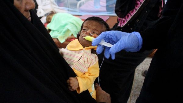 Children hit hardest in the Yemeni war 