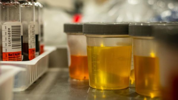 إذا كان بولك شفاف تماماً، فهذه علامة على أنك تشرب الكثير من المياه