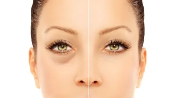 استخدام مستحضرات التجميل. إذا كنتِ ترغبين في إخفاء الهالات أسفل العين