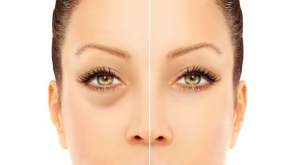 استخدام مستحضرات التجميل. إذا كنتِ ترغبين في إخفاء الهالات أسفل العين