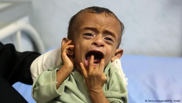 Spare a thought for the Yemeni kids 