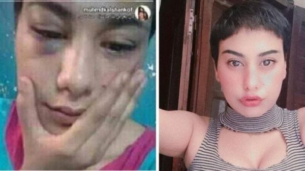 منة عبد العزيز