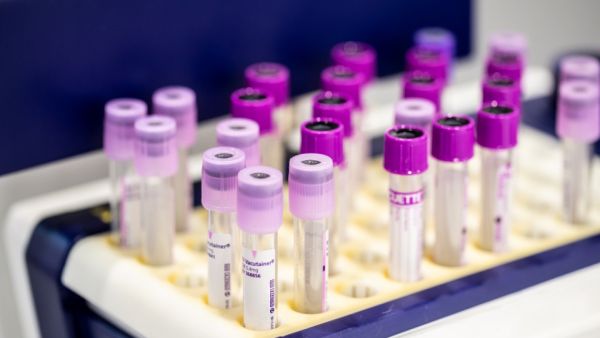 The global in-vitro diagnostics industry topped US$ 85.9 billion in 2020 Medlab Middle East To Address Increased Demand For Covid-19 Testing