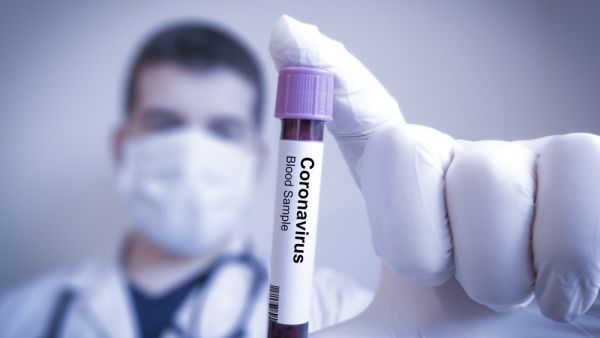 covid-19 cases are below 1000 in saudi arabia