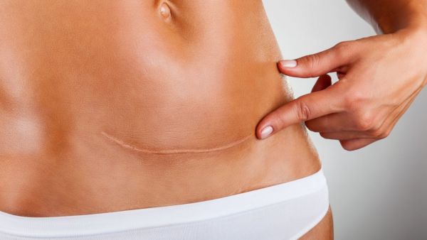 هناك علامات قد تشير لإصابة الجرح بعدوى، عليكِ حينها استشارة الطبيب على الفور