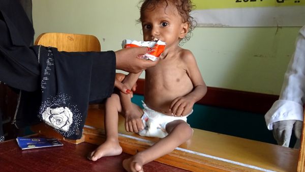 Yemenis set to face famine and related diseases.