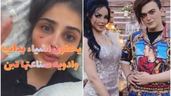 شهاب وصباح / الفتاة صاحبة العملية التجميلة الفاشلة