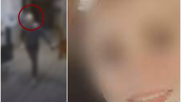 شاب يمزق وجه زميلته بالعمل بـ"مشرط" في الأردن