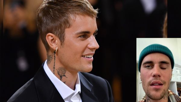 Justin Bieber has facial paralysis