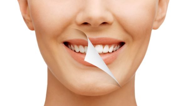 تنظيف الأسنان عند الطبيب بانتظام..الإيجابيات والسلبيات